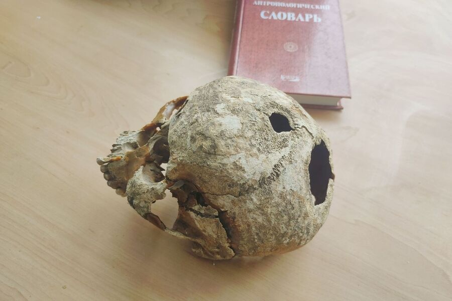 Трепанированный череп обнаружили археологи на раскопках в Городце - фото 1