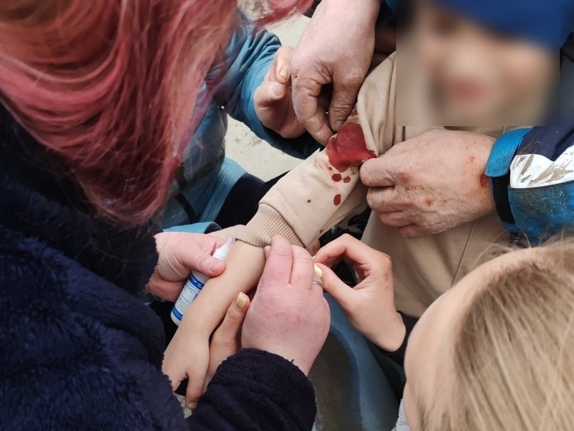 Бойцовская собака напала на четырехлетнего ребенка в Нижегородской области - фото 1